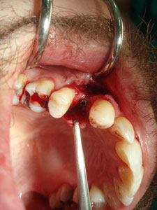 Chirurgia orale e paradontologia